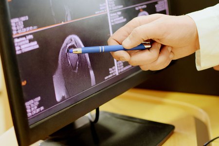 Untersuchungsergebnis des offenen MRTs am Computer